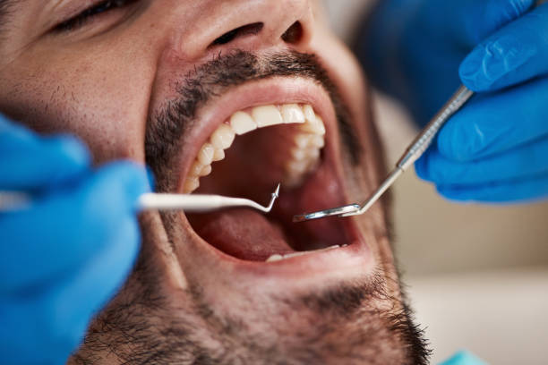 Emergency Gum Pain Relief in KS